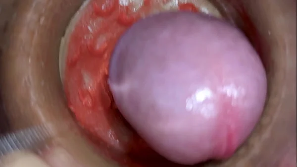 Camera Inside Deep Pussy Captures Huge Ejaculation of Sperm 4k