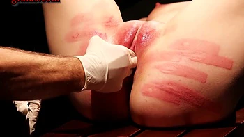 The Cost Of Submission