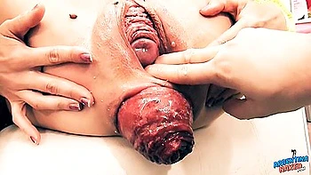 Astonishing Porn Video Extreme Insertion Hottest Uncut